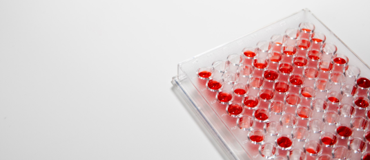 Болезнь в пробирке. Как можно воссоздать ревматоидный артрит и протестировать лекарства в лаборатории